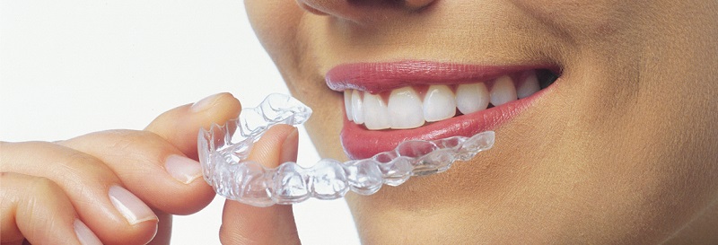 7 Reasons Teens Like Invisalign